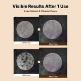 Triple Cleansing Method Bundle
