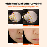 NIDA Ultimate Dark Spot Brightening Bundle